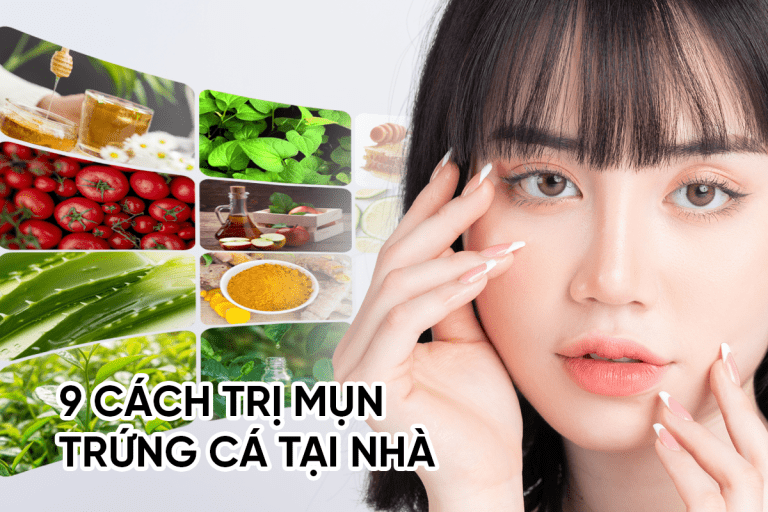 9 cách trị mụn trứng cá tại nhà