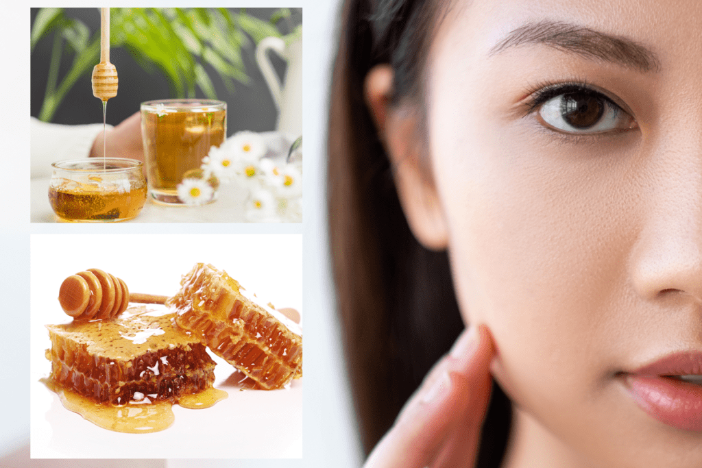 Sử dụng mật ong trị mụn trứng cá