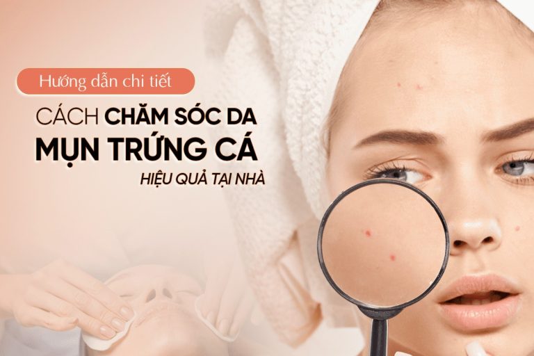 Hướng dẫn chăm sóc da mụn trứng cá