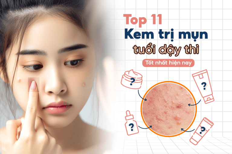 Review 11 kem trị mụn cho tuổi dậy thì hiệu quả nhất