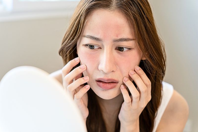 Vì sao da nhạy cảm bị nổi mụn