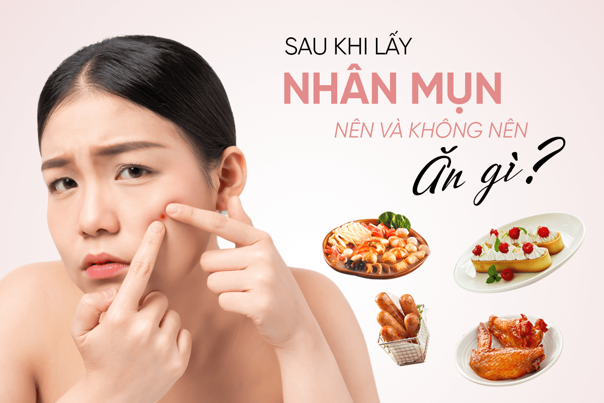 Sau khi lấy nhận mụn nên và không nên ăn gì