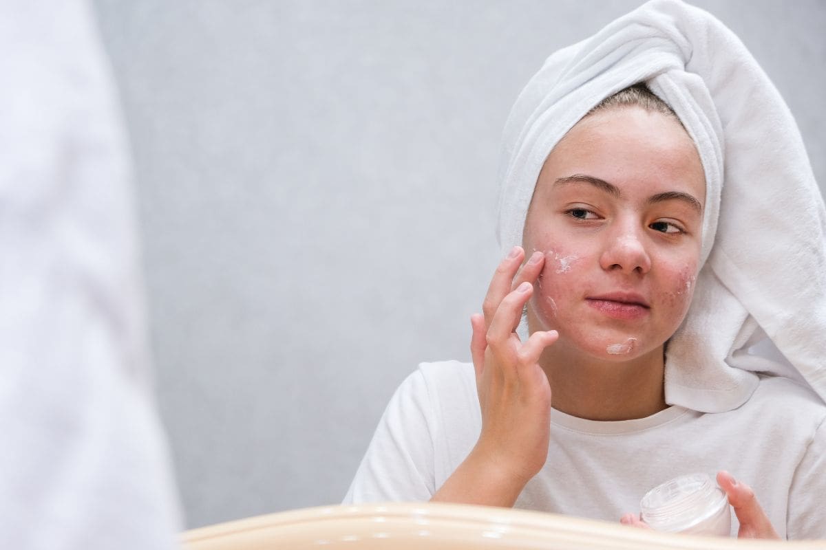 Nên thoa kem trị mụn trước kem dưỡng ẩm